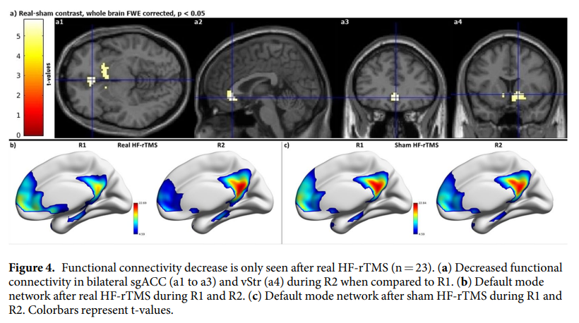 HF-rTMS